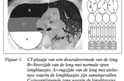 Mechanische beademing