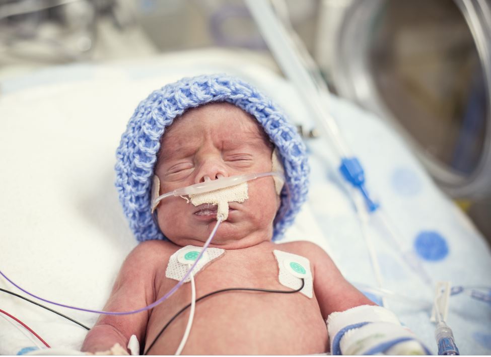 Verhoogd risico op blijvende hersenschade bij baby’s met aangeboren afwijkingen