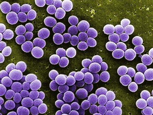 staphylococcus-aureus.png