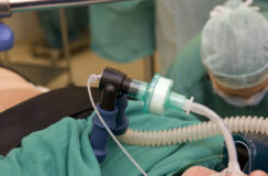 Voorkomen van post-intubatieklachten