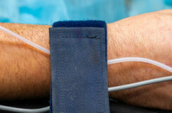 Gevolgen fysieke fixatie voor welzijn patiënt