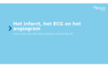 Het infarct, het ECG en het angiogram