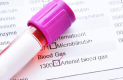 Venticare Casus – Januari 2026