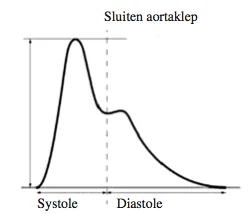De_intra_aortale_ballonpomp_op_de_icu_afbeelding_1.png