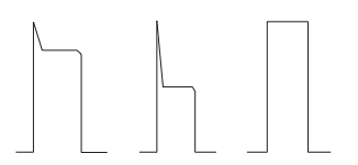De_intra_aortale_ballonpomp_op_de_icu_afbeelding_3.png