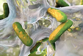 Sepsis-syndroom-geen-ziekte.jpg
